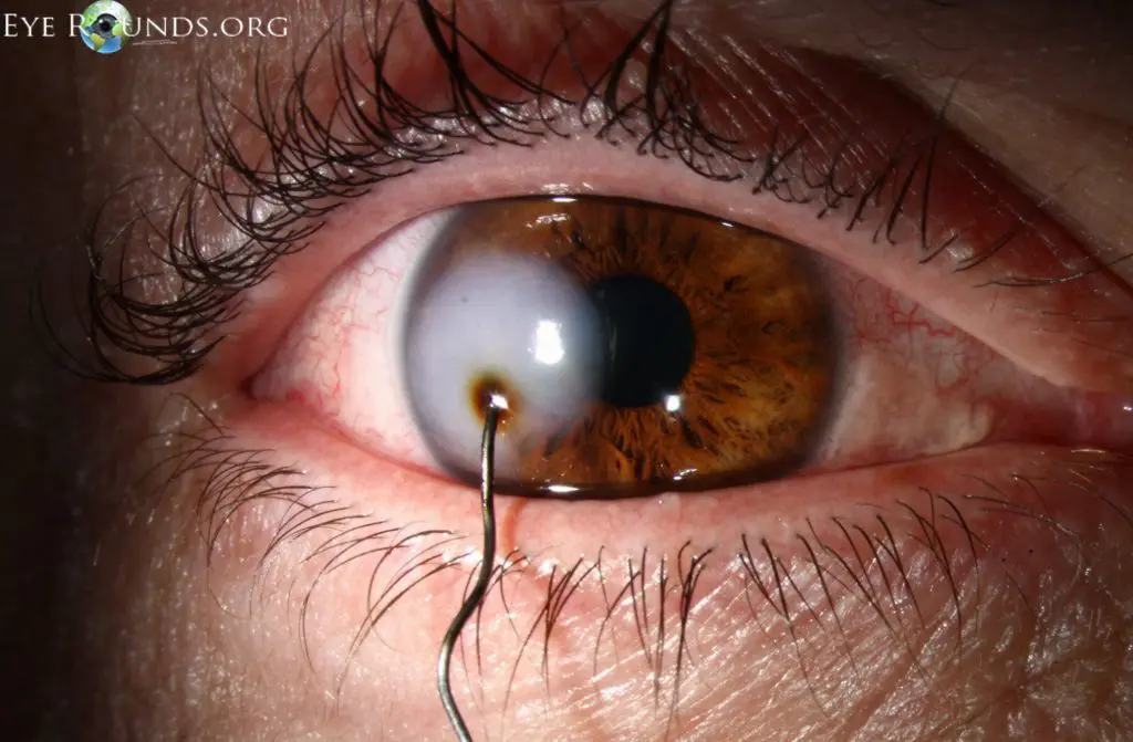 Mois de la santé visuelle